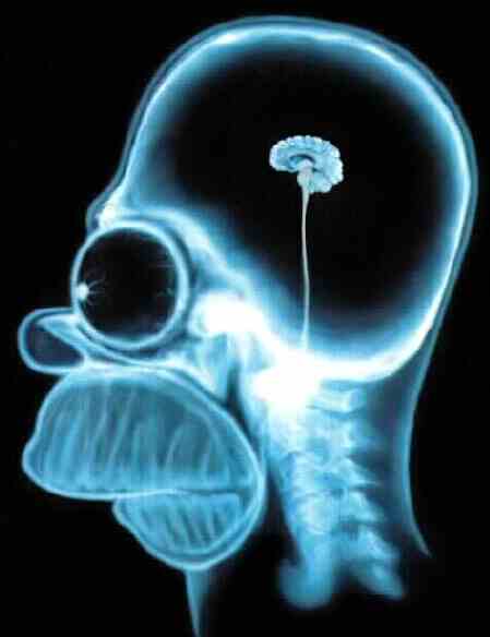Enfin la technologie nous permet de voir le cerveau d'un Simson !