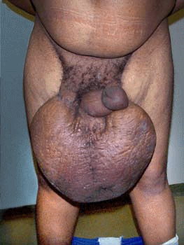 Pauvre homme !